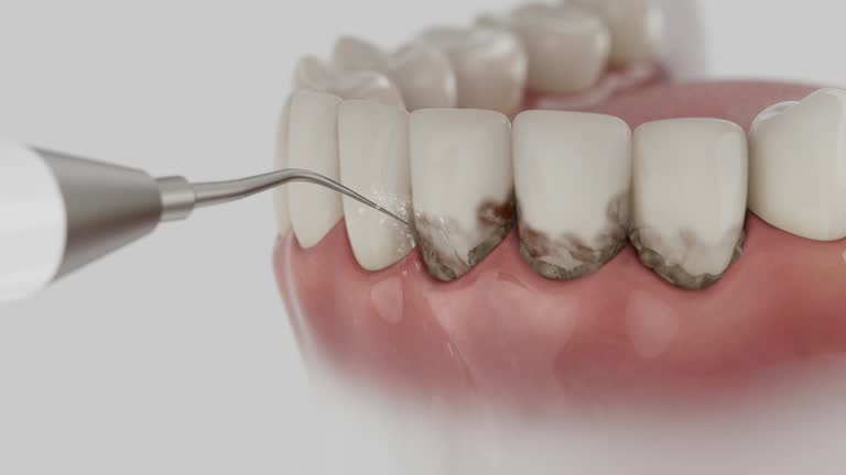 Trusted Tooth Extraction service in Whitmore Lake, MI - Dentist Open Now